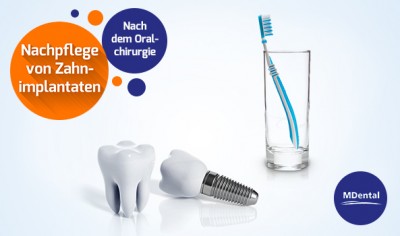 MDental Klinik Ungarn_Nachpflege von Zahnimplantaten