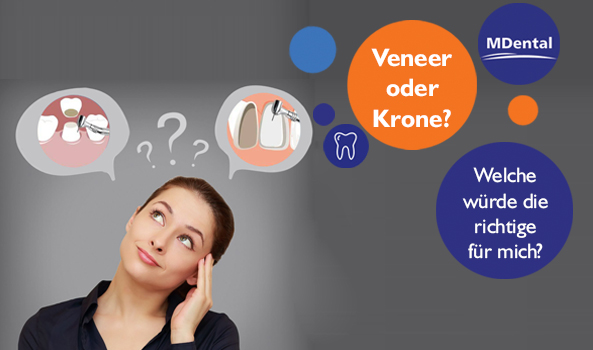 Veneers oder Krone